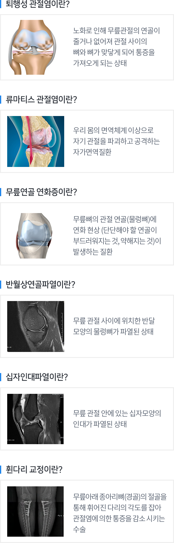 관절센터 - 무릎 내용