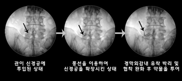 주사기 등 의료 용품이 있는 사진